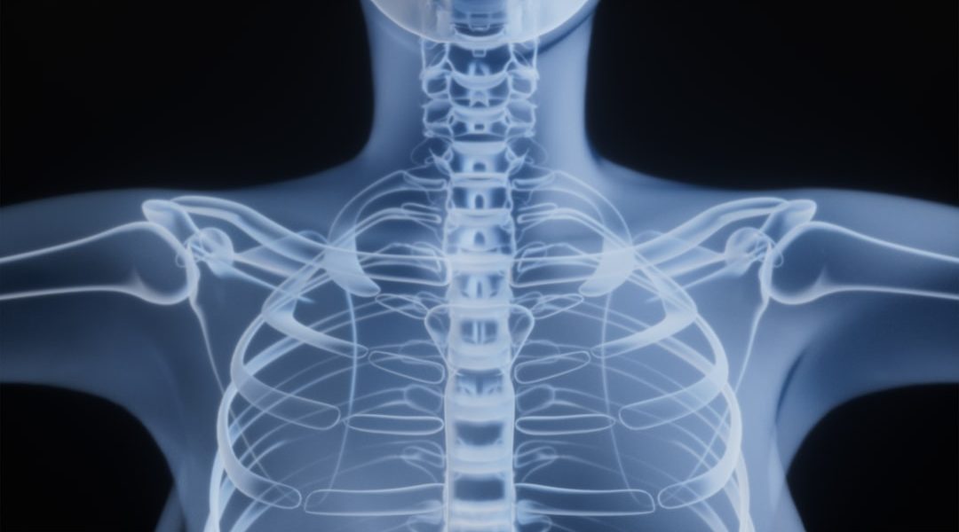 X-ray image of a human spine and ribcage