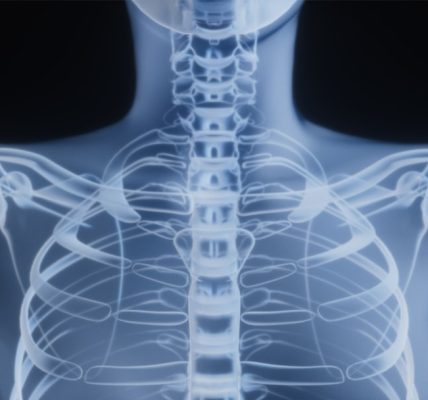 X-ray image of a human spine and ribcage