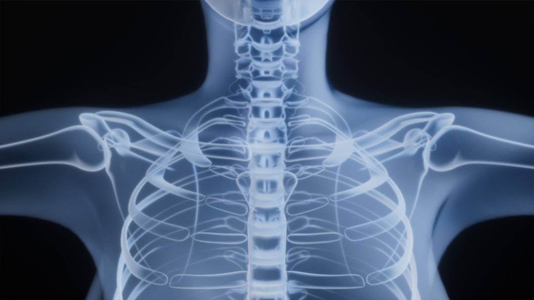 X-ray image of a human spine and ribcage